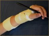 TheraTogs ULTRA Wrist & Thumb System